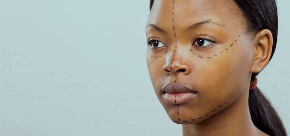 Before and After Result